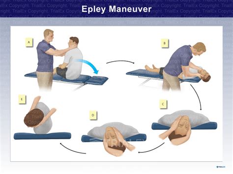 Epley Maneuver - Trial Exhibits Inc.