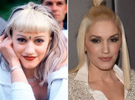 Gwen Stefani plastic surgery enhancements