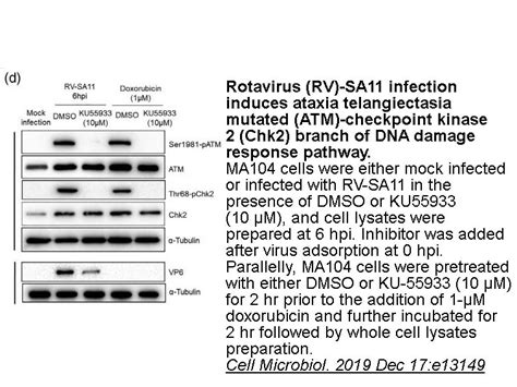 APExBIO - KU 55933|ATM inhibitor,potent and selective|CAS# 587871-26-9