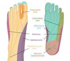 Medial Calcaneal Nerve Entrapment - Symptoms & Treatment