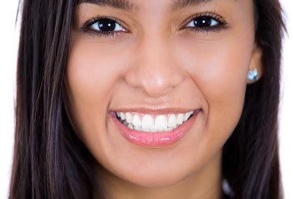 Smile Bright With Veneers! - SOLDENTAL