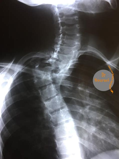 Congenital Deformity - Dr Nouraei