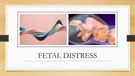 FEtal distress.pptx