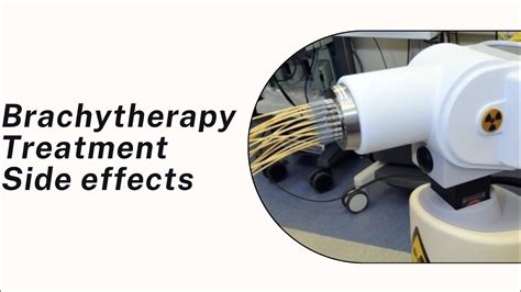 Brachytherapy side effects | Radiotherapy Edutech | Radiotherapy side effects - YouTube