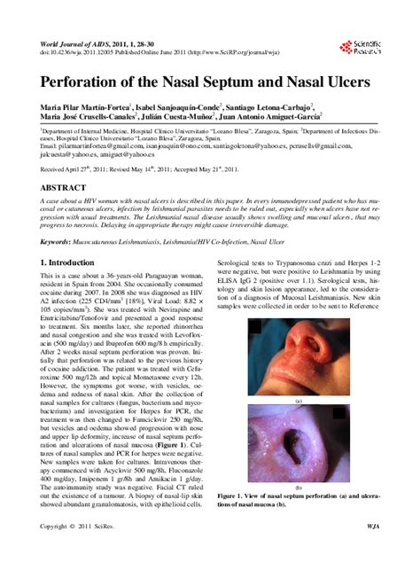 (PDF) Perforation of the Nasal Septum and Nasal Ulcers | Isabel ...