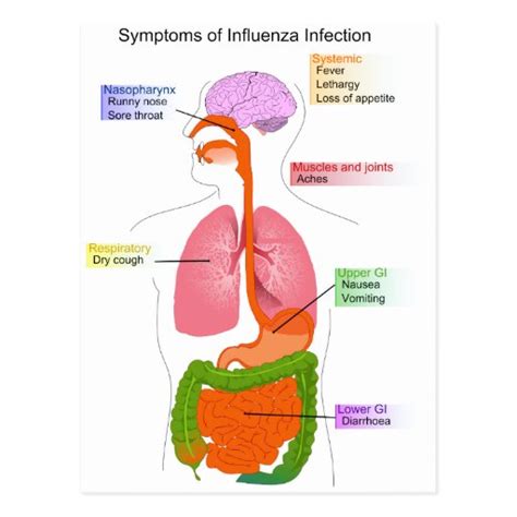 Main Symptoms of an Influenza Infection Diagram Postcard | Zazzle