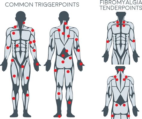 Back Massage Chart Of Pressure Points