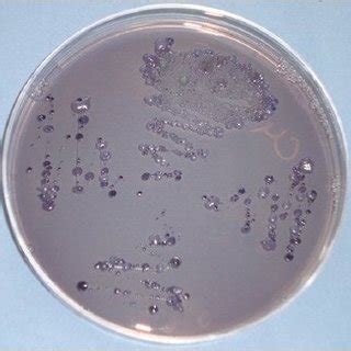 Gram staining - Streptococcus mutans | Download Scientific Diagram