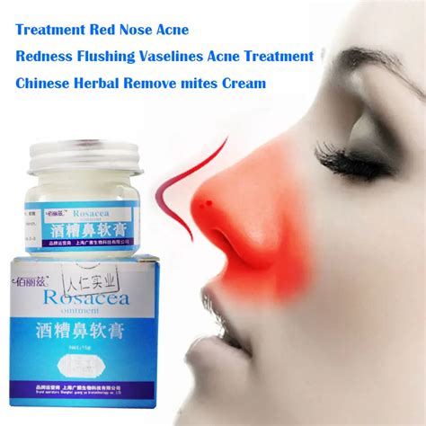 Rosacea Cream Red Nose Ointment Remove Blackhead Acne Cream Skin Care ...