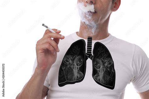 Man with black lungs smoking cigarette isoleted on white bakground ...