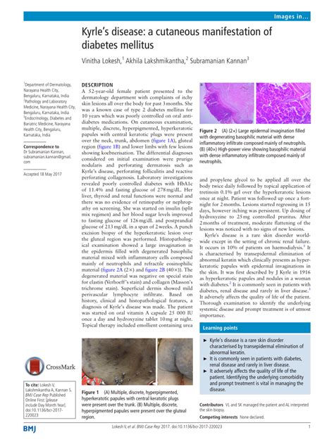 (PDF) Kyrle’s disease: a cutaneous manifestation of diabetes mellitus