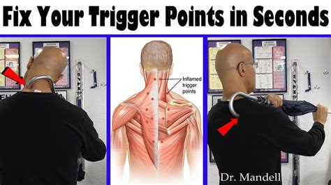 Relieve Your Trigger Points In Seconds & Fix Neck Pain - Dr Alan Mandell, DC - YouTube