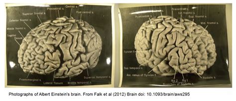 The Myth of Einstein’s Brain? | Techy World