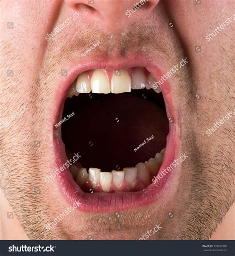 Male Screaming Open Mouth Teeth Stock Photo 134551898 - Shutterstock