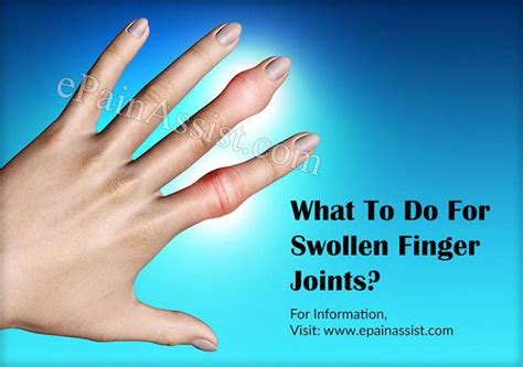 Swollen Finger Joints | Arthritis in fingers, Finger joint, Rheumatoid arthritis symptoms