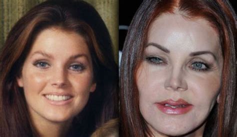 Priscilla Presley - plastic surgery disaster