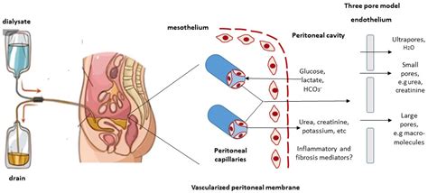 Membranes | Free Full-Text | The Peritoneal Membrane—A Potential Mediator of Fibrosis and ...