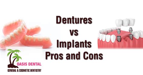 Dentures vs Implants Pros and Cons - Oasis Dental Blog - Oasis Dental