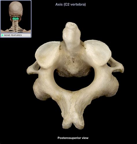 Axis Vertebrae Diagram | Quizlet