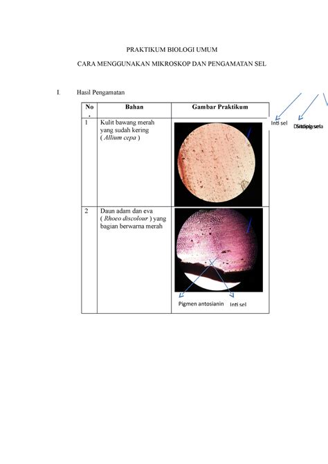 Laporan Praktikum Cara Menggunakan Mikroskop Dan Pengamatan Sel Hot ...