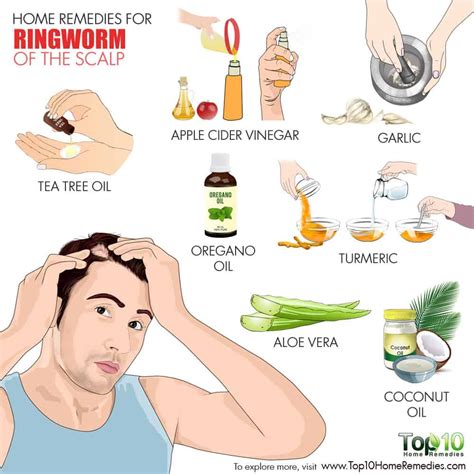 How to Cure Scalp Ringworm | imap.pk | Pakistan Business Directory