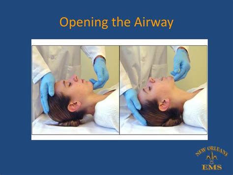 PPT - New Orleans EMS Airway Lecture Series: Lecture 2 Oxygenation and Bag-Mask Ventilation ...