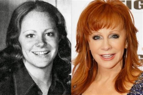 Chatter Busy: Reba McEntire Plastic Surgery