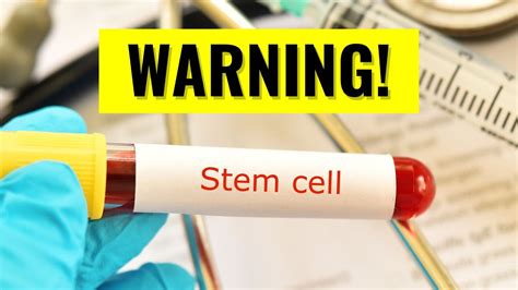 Warning: The Truth About Stem Cell Therapy for Arthritis