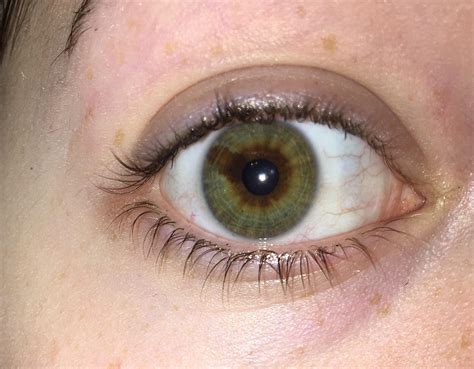 I have a brown line through the green of my eye, also known as sectoral heterochromia : r ...