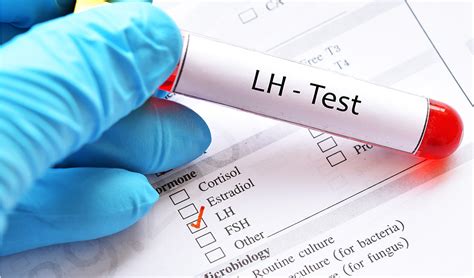 All About LH (Luteinizing Hormone) and LH Test | Bahçeci Blog