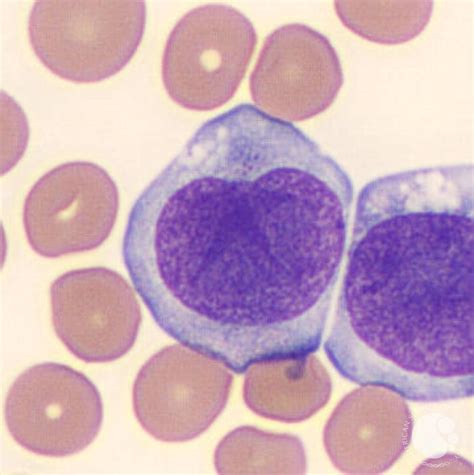 Promonocytes Medical Laboratory Science, Pathology, Visual Arts ...