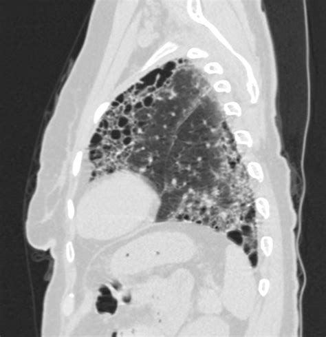 000 Honeycomb Lung | Lungs