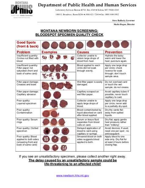 Blood Spot Specimen Quality Check | Baby's First Test | Newborn ...