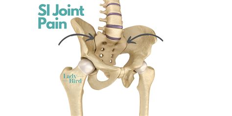 8 ways to manage Sacroiliac Joint pain during pregnancy — Lady Bird PT