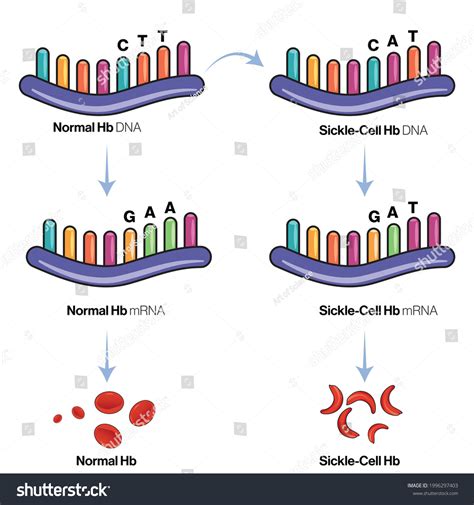 Genetic Mechanism Genetics Sickle Cell Anemia Stok Vektör (Telifsiz ...