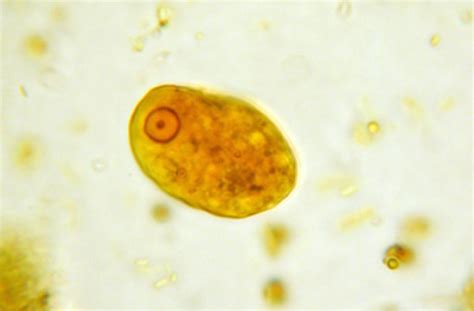 Entamoeba coli parasite | Medical Laboratories