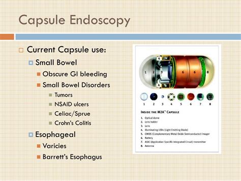 PPT - Capsule Endoscopy PowerPoint Presentation, free download - ID:4521276