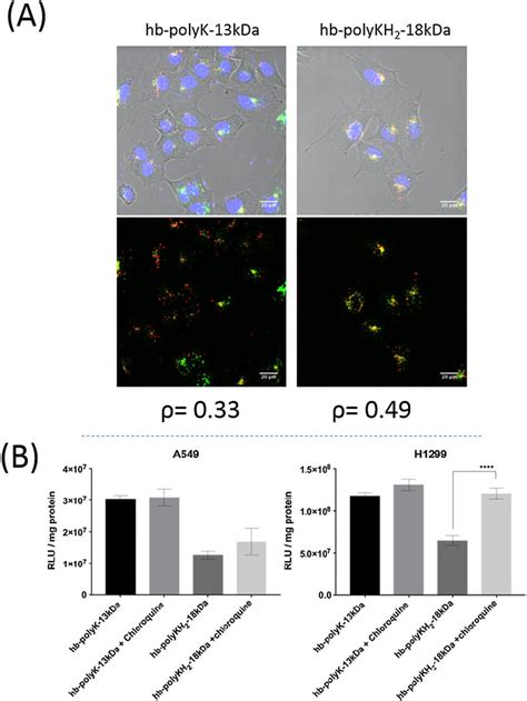 (A) Confocal images of LysoTracker experiment and (B) % luciferase ...