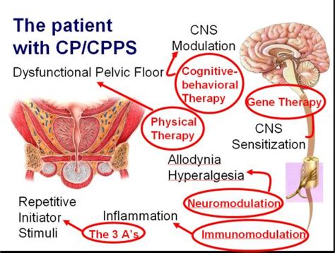 Chronic Pelvic Pain Syndrome. Causes, symptoms, treatment Chronic ...