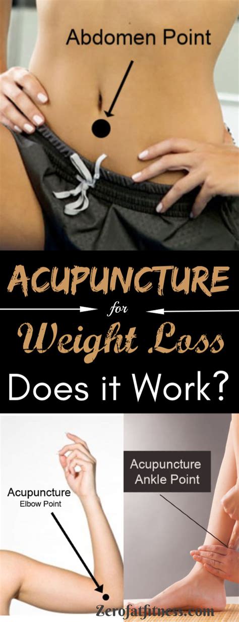 Acupuncture for Weight Loss - How Does it Work? | Zerofatfitness