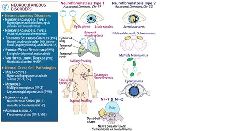 USMLE / COMLEX - Step 2: Neurocutaneous Disorders, Part 1 | Draw It to Know It