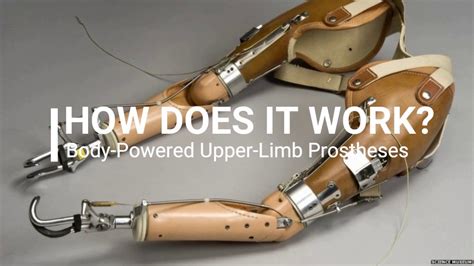 How Does a Body Powered Upper Limb Prostheses Work - YouTube