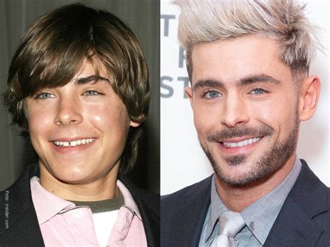 Famosos antes y ahora...¡Sus transformaciones son increíbles! - Vibra