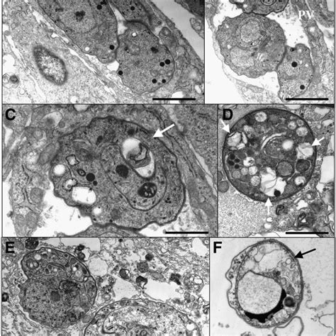 Effects of thioureides on T. gondii tachyzoites grown on confluent HFF... | Download Scientific ...