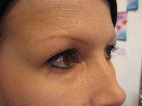 Image Perfect: Eyebrow Shape & Restoration Before & After