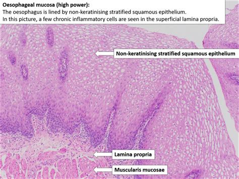 Oesophagus – Normal Histology – NUS Pathweb :: NUS Pathweb