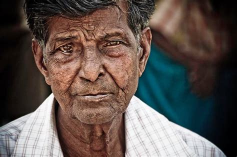 Leprosy: What It Is, What It’s Not, and How You Can Help - Embrace A ...