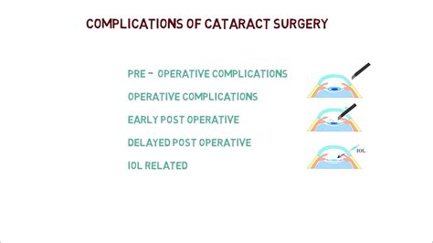 Cataract Surgery Complications in Elderly - DaneqoVillanueva