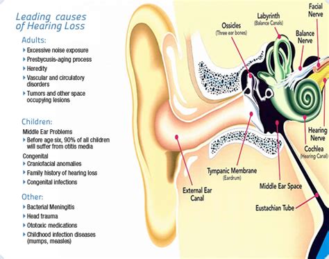 Hearing Loss - Polo Park Hearing Centre Winnipeg Hearing Aids