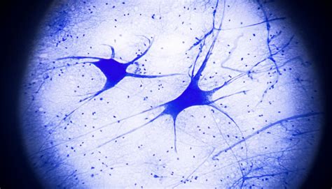 Scientists create new motor neurons out of skin cells - Futurity